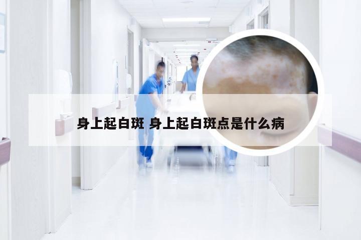 身上起白斑 身上起白斑点是什么病