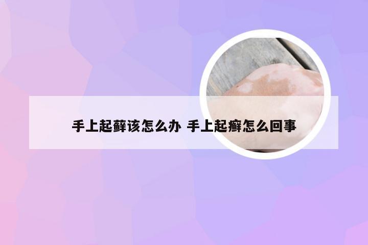 手上起藓该怎么办 手上起癣怎么回事