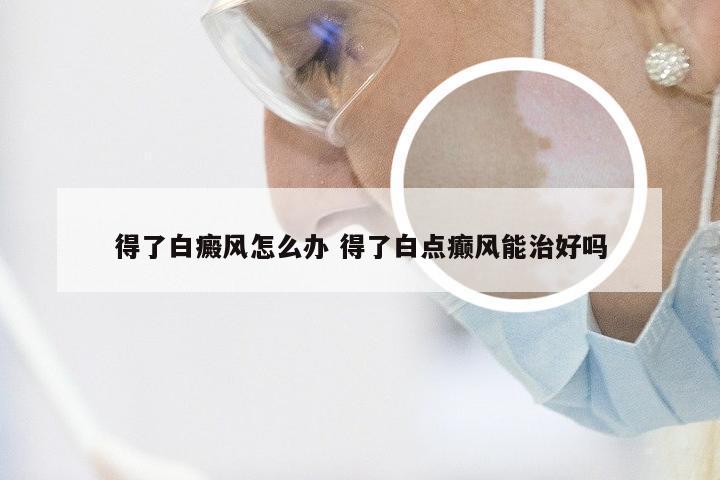 得了白癜风怎么办 得了白点癫风能治好吗