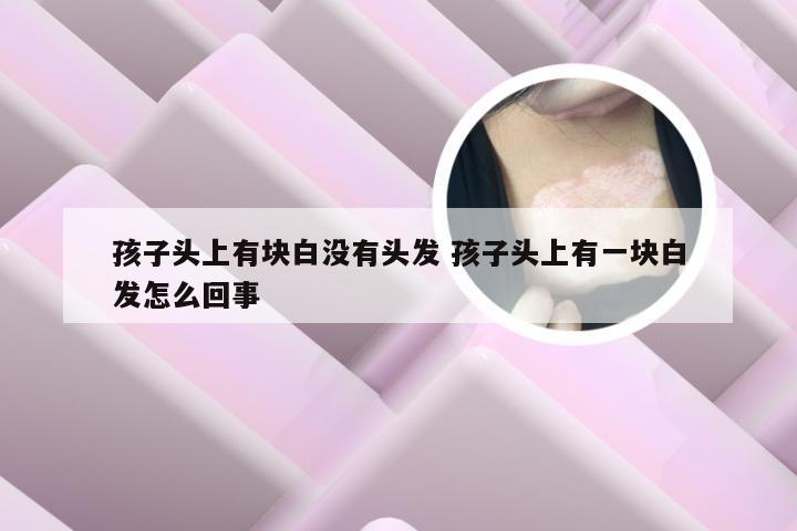 孩子头上有块白没有头发 孩子头上有一块白发怎么回事