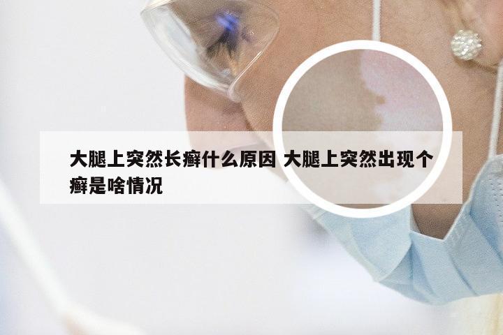 大腿上突然长癣什么原因 大腿上突然出现个癣是啥情况