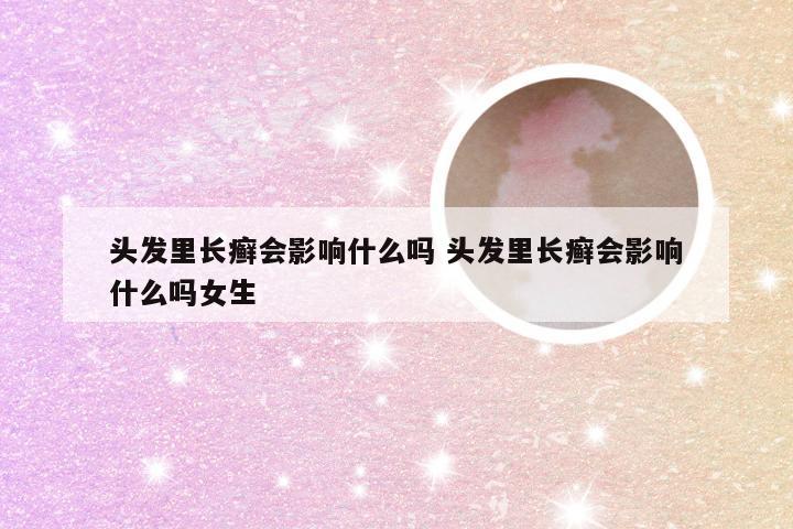 头发里长癣会影响什么吗 头发里长癣会影响什么吗女生