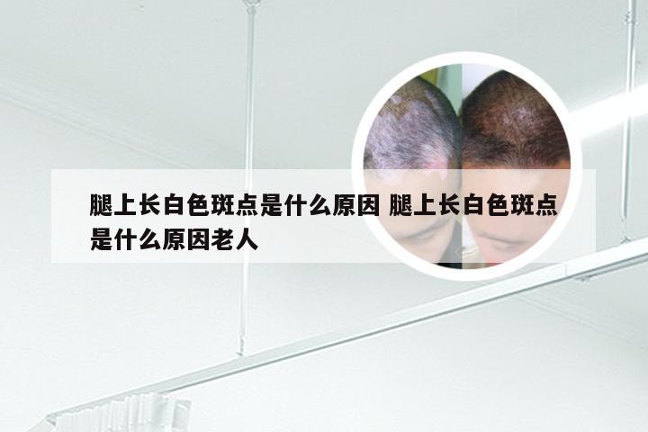 腿上长白色斑点是什么原因 腿上长白色斑点是什么原因老人