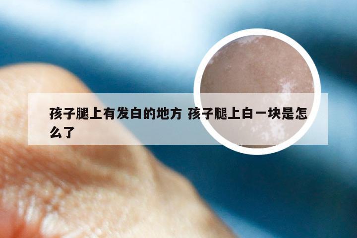 孩子腿上有发白的地方 孩子腿上白一块是怎么了