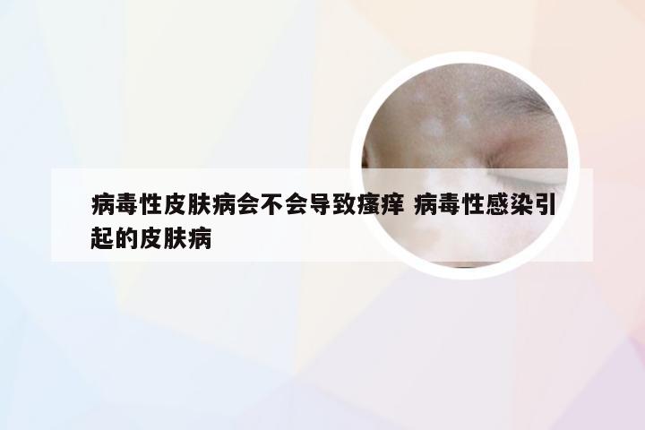 病毒性皮肤病会不会导致瘙痒 病毒性感染引起的皮肤病