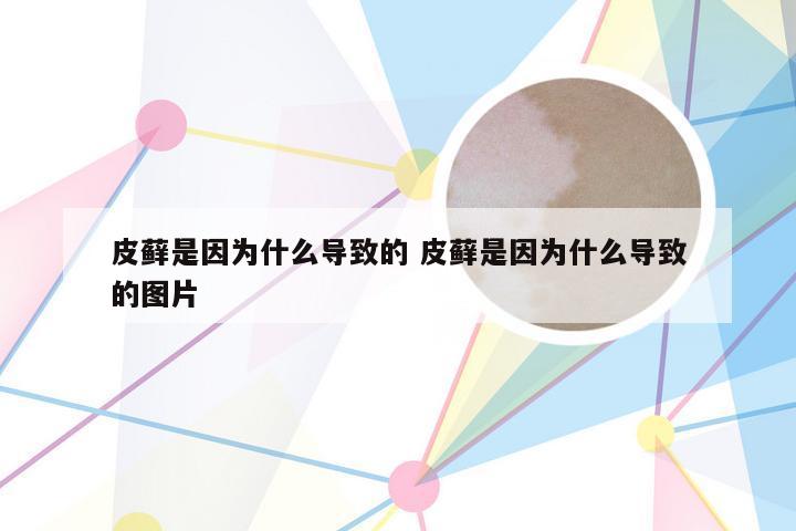 皮藓是因为什么导致的 皮藓是因为什么导致的图片