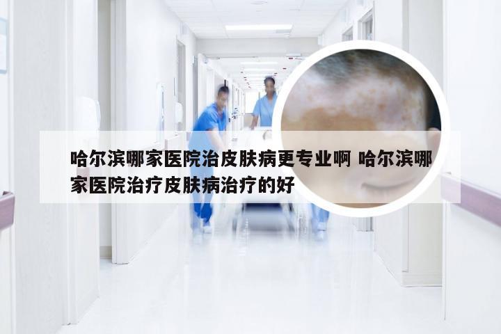 哈尔滨哪家医院治皮肤病更专业啊 哈尔滨哪家医院治疗皮肤病治疗的好