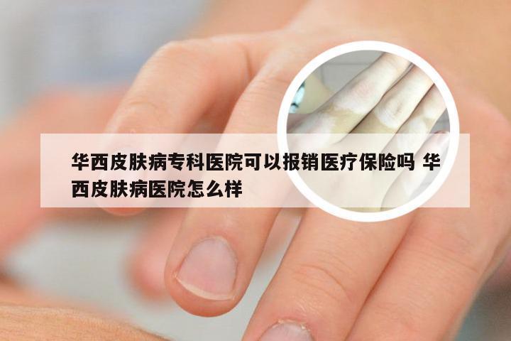 华西皮肤病专科医院可以报销医疗保险吗 华西皮肤病医院怎么样