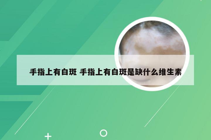 手指上有白斑 手指上有白斑是缺什么维生素