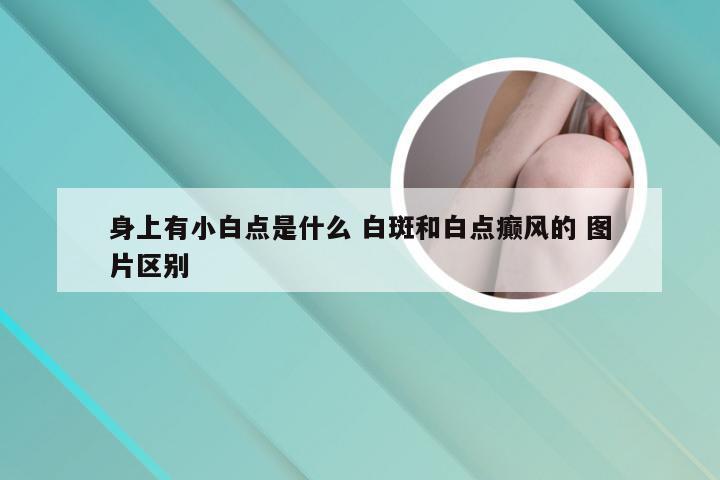 身上有小白点是什么 白斑和白点癫风的 图片区别