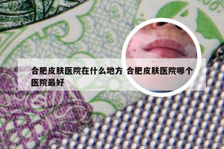 合肥皮肤医院在什么地方 合肥皮肤医院哪个医院最好