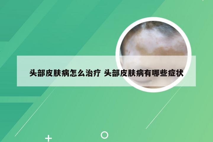 头部皮肤病怎么治疗 头部皮肤病有哪些症状