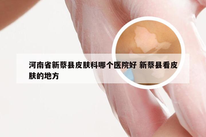 河南省新蔡县皮肤科哪个医院好 新蔡县看皮肤的地方