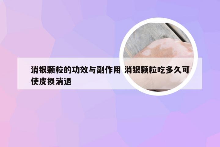 消银颗粒的功效与副作用 消银颗粒吃多久可使皮损消退