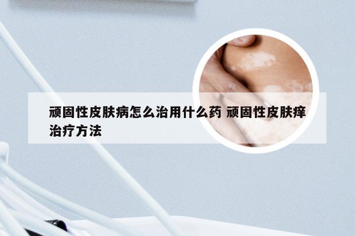 顽固性皮肤病怎么治用什么药 顽固性皮肤痒治疗方法