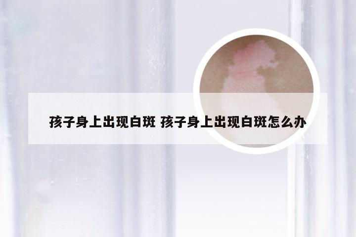 孩子身上出现白斑 孩子身上出现白斑怎么办