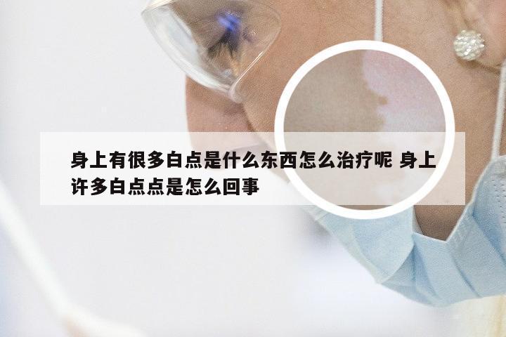 身上有很多白点是什么东西怎么治疗呢 身上许多白点点是怎么回事