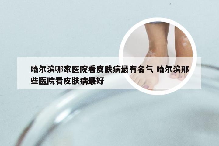 哈尔滨哪家医院看皮肤病最有名气 哈尔滨那些医院看皮肤病最好