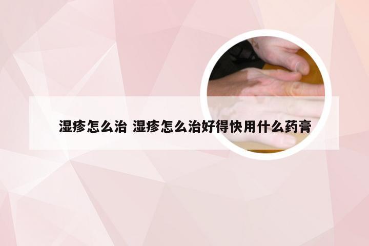 湿疹怎么治 湿疹怎么治好得快用什么药膏