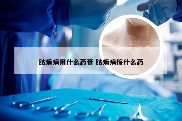 脓疱病用什么药膏 脓疱病擦什么药