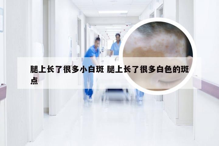 腿上长了很多小白斑 腿上长了很多白色的斑点