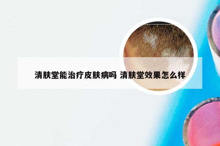 清肤堂能治疗皮肤病吗 清肤堂效果怎么样