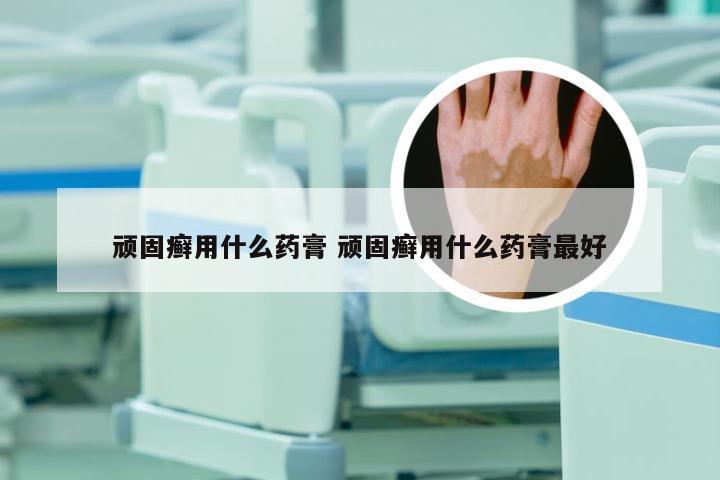 顽固癣用什么药膏 顽固癣用什么药膏最好