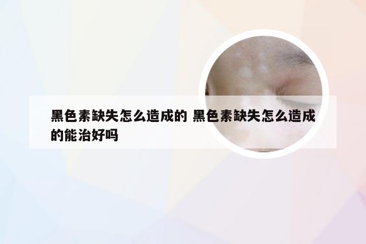 黑色素缺失怎么造成的 黑色素缺失怎么造成的能治好吗