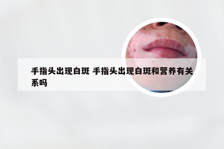 手指头出现白斑 手指头出现白斑和营养有关系吗