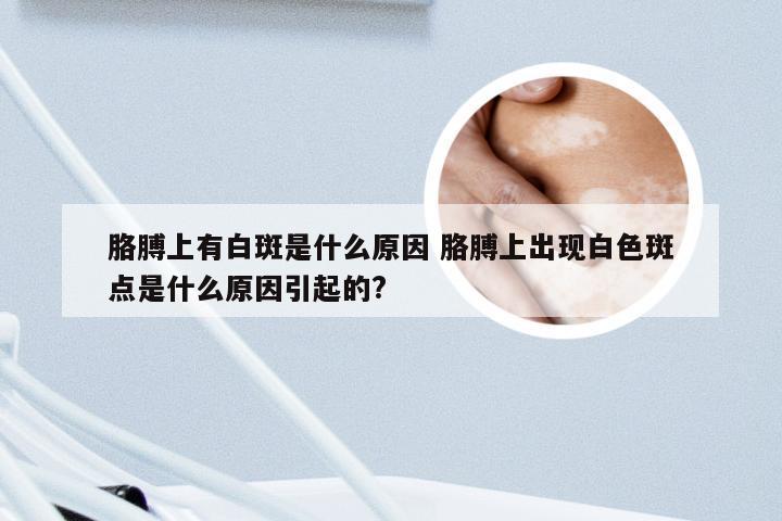 胳膊上有白斑是什么原因 胳膊上出现白色斑点是什么原因引起的?