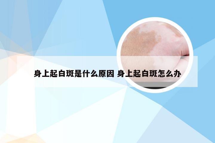 身上起白斑是什么原因 身上起白斑怎么办