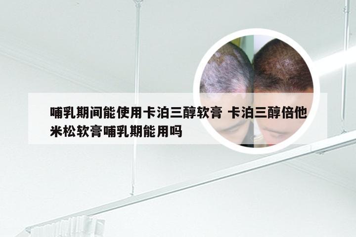 哺乳期间能使用卡泊三醇软膏 卡泊三醇倍他米松软膏哺乳期能用吗