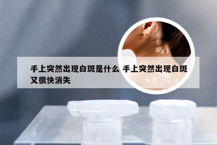 手上突然出现白斑是什么 手上突然出现白斑又很快消失