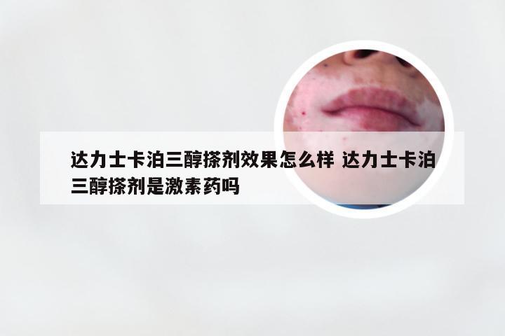 达力士卡泊三醇搽剂效果怎么样 达力士卡泊三醇搽剂是激素药吗