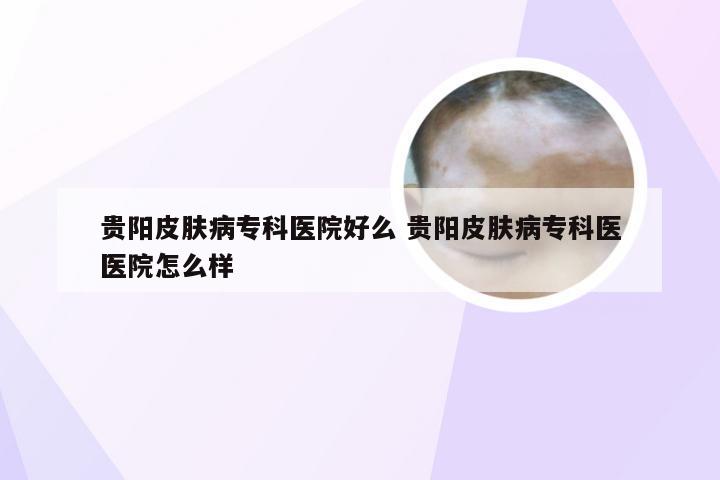 贵阳皮肤病专科医院好么 贵阳皮肤病专科医医院怎么样