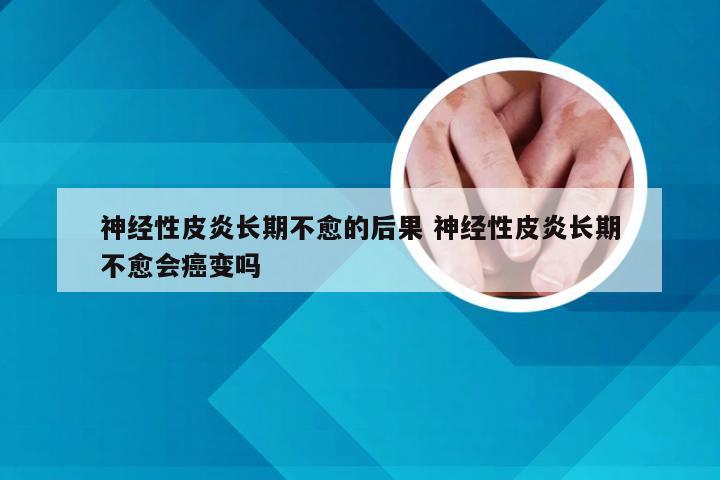 神经性皮炎长期不愈的后果 神经性皮炎长期不愈会癌变吗