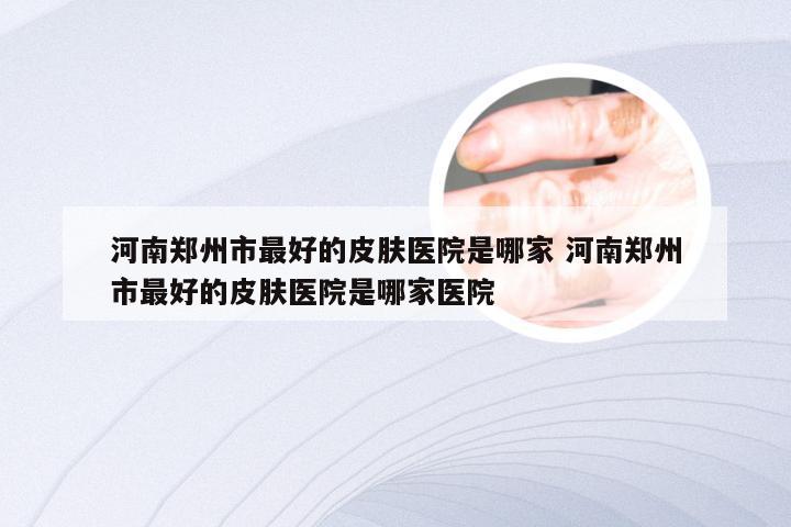 河南郑州市最好的皮肤医院是哪家 河南郑州市最好的皮肤医院是哪家医院