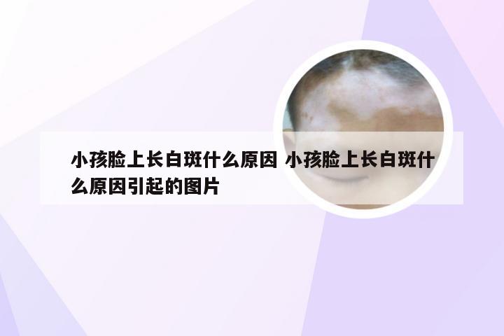 小孩脸上长白斑什么原因 小孩脸上长白斑什么原因引起的图片