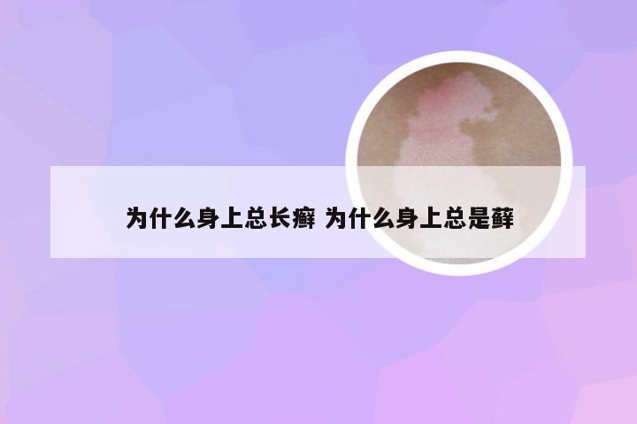 为什么身上总长癣 为什么身上总是藓