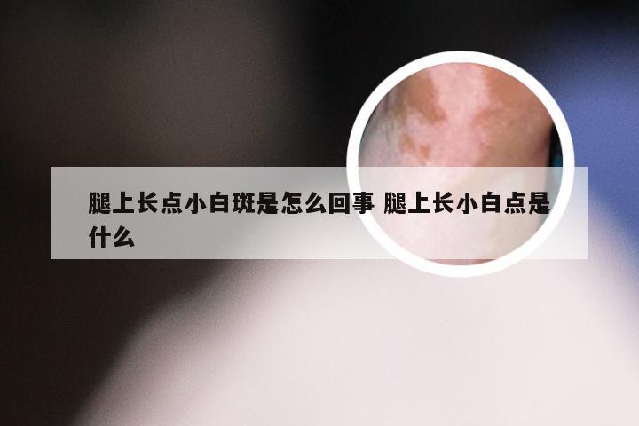 腿上长点小白斑是怎么回事 腿上长小白点是什么