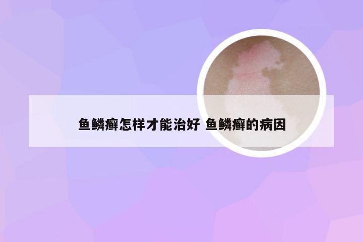 鱼鳞癣怎样才能治好 鱼鳞癣的病因