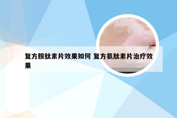 复方胺肽素片效果如何 复方氨肽素片治疗效果