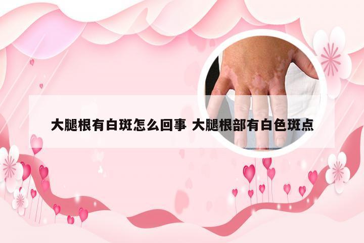 大腿根有白斑怎么回事 大腿根部有白色斑点