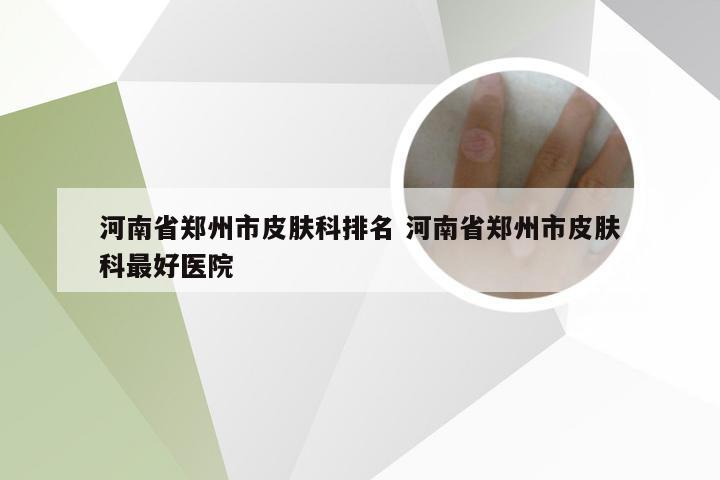 河南省郑州市皮肤科排名 河南省郑州市皮肤科最好医院