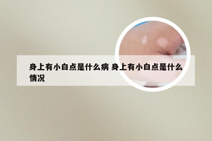 身上有小白点是什么病 身上有小白点是什么情况