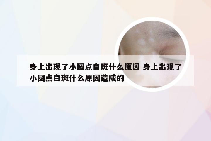 身上出现了小圆点白斑什么原因 身上出现了小圆点白斑什么原因造成的