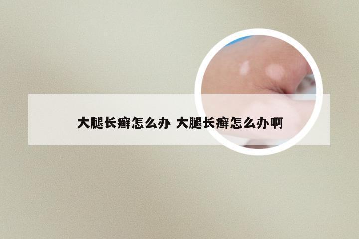 大腿长癣怎么办 大腿长癣怎么办啊