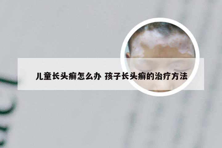 儿童长头癣怎么办 孩子长头癣的治疗方法