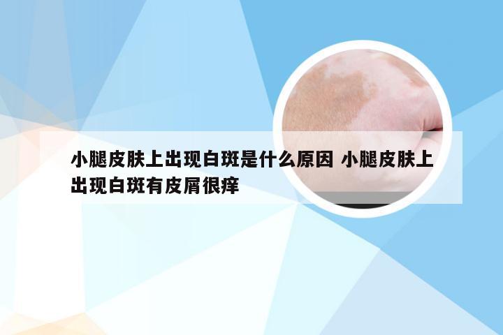 小腿皮肤上出现白斑是什么原因 小腿皮肤上出现白斑有皮屑很痒