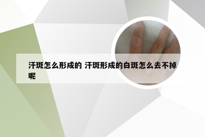 汗斑怎么形成的 汗斑形成的白斑怎么去不掉呢